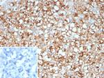 Stathmin 1/STMN1 Antibody in Immunohistochemistry (Paraffin) (IHC (P))