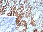 Stathmin 1/STMN1 Antibody in Immunohistochemistry (Paraffin) (IHC (P))