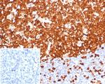 Stathmin 1/STMN1 Antibody in Immunohistochemistry (Paraffin) (IHC (P))