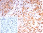 Stathmin 1/STMN1 Antibody in Immunohistochemistry (Paraffin) (IHC (P))