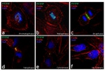 INCENP Antibody in Immunocytochemistry (ICC/IF)