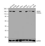 MSH6 Antibody in Western Blot (WB)