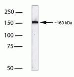 MSH6 Antibody in Western Blot (WB)