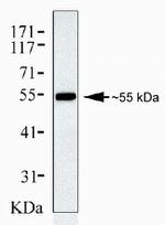 beta Arrestin 1 Antibody in Western Blot (WB)