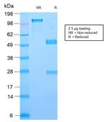 Galectin-1/Human Placental Lactogen (hPL) Antibody in SDS-PAGE (SDS-PAGE)