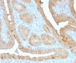 Galectin-3 (LGALS3) (Thyroid Cell Marker) Antibody in Immunohistochemistry (Paraffin) (IHC (P))