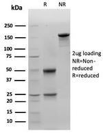 Galectin-3 (LGALS3) (Thyroid Cell Marker) Antibody in SDS-PAGE (SDS-PAGE)