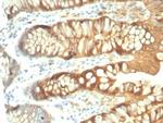 Galectin-3 (LGALS3) (Thyroid Cell Marker) Antibody in Immunohistochemistry (Paraffin) (IHC (P))