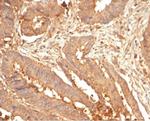 Galectin-3 (LGALS3) (Thyroid Cell Marker) Antibody in Immunohistochemistry (Paraffin) (IHC (P))