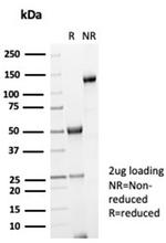 Galectin-3 (LGALS3) (Thyroid Cell Marker) Antibody in SDS-PAGE (SDS-PAGE)