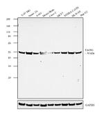 TACR1 Antibody in Western Blot (WB)