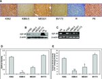 IGF1R beta Antibody in Western Blot, Immunohistochemistry (WB, IHC)