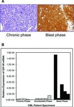 IGF1R beta Antibody in Immunohistochemistry (IHC)