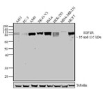 IGF1R beta Antibody in Western Blot (WB)