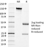 Luteinizing Hormone/Choriogonadotropin Receptor (LHCGR) Antibody in SDS-PAGE (SDS-PAGE)