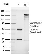 Luteinizing Hormone/Choriogonadotropin Receptor (LHCGR) Antibody in SDS-PAGE (SDS-PAGE)