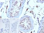 Luteinizing Hormone/Choriogonadotropin Receptor (LHCGR) Antibody in Immunohistochemistry (Paraffin) (IHC (P))