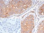 Luteinizing Hormone/Choriogonadotropin Receptor (LHCGR) Antibody in Immunohistochemistry (Paraffin) (IHC (P))