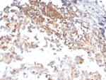 Luteinizing Hormone/Choriogonadotropin Receptor (LHCGR) Antibody in Immunohistochemistry (Paraffin) (IHC (P))