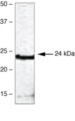 HOXB7 Antibody in Western Blot (WB)