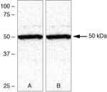 TXNIP Antibody in Western Blot (WB)