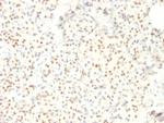 LMO2 (B-Cell Marker) Antibody in Immunohistochemistry (Paraffin) (IHC (P))