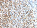 LMO2 (B-Cell Marker) Antibody in Immunohistochemistry (Paraffin) (IHC (P))