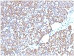 LMO2 (B-Cell Marker) Antibody in Immunohistochemistry (Paraffin) (IHC (P))