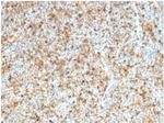 LMO2 (B-Cell Marker) Antibody in Immunohistochemistry (Paraffin) (IHC (P))