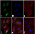 Phospho-SMAD2 (Ser465, Ser467) Antibody in Immunocytochemistry (ICC/IF)