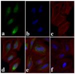 Phospho-SMAD2 (Ser465, Ser467) Antibody