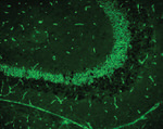 ZO-1 Antibody in Immunohistochemistry (IHC)