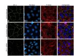 ZO-1 Antibody in Immunocytochemistry (ICC/IF)