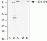 ZO-1 Antibody in Western Blot (WB)