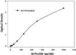 Human Amyloid beta 40 ELISA Kit