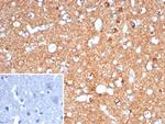 CD91/LDL Receptor Related Protein 1 (LRP1) Antibody in Immunohistochemistry (Paraffin) (IHC (P))