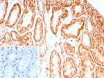 CD91/LDL Receptor Related Protein 1 (LRP1) Antibody in Immunohistochemistry (Paraffin) (IHC (P))