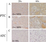 TXNIP Antibody in Immunohistochemistry (IHC)