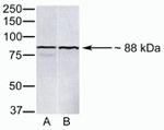 PARP9 Antibody in Western Blot (WB)