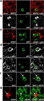 alpha Synuclein Antibody in Immunohistochemistry (IHC)