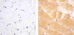 JPH2 Antibody in Immunohistochemistry (Paraffin) (IHC (P))