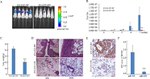 Metadherin Antibody in Immunohistochemistry (IHC)