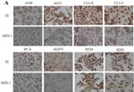 Metadherin Antibody in Immunohistochemistry (IHC)