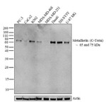 Metadherin Antibody in Western Blot (WB)