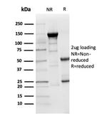 CD205/LY75/DEC-205 Antibody in SDS-PAGE (SDS-PAGE)