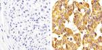 Metadherin Antibody in Immunohistochemistry (Paraffin) (IHC (P))