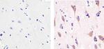 DISC1 Antibody in Immunohistochemistry (Paraffin) (IHC (P))