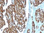 TACSTD2/TROP2 Antibody in Immunohistochemistry (Paraffin) (IHC (P))