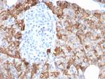 TACSTD2/TROP2 Antibody in Immunohistochemistry (Paraffin) (IHC (P))