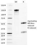 TACSTD2/TROP2 Antibody in SDS-PAGE (SDS-PAGE)